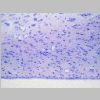 Neuronas Nissl 24.jpg